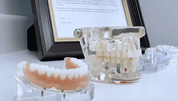 Dentist_In_North_Hollywood_CA_service_image