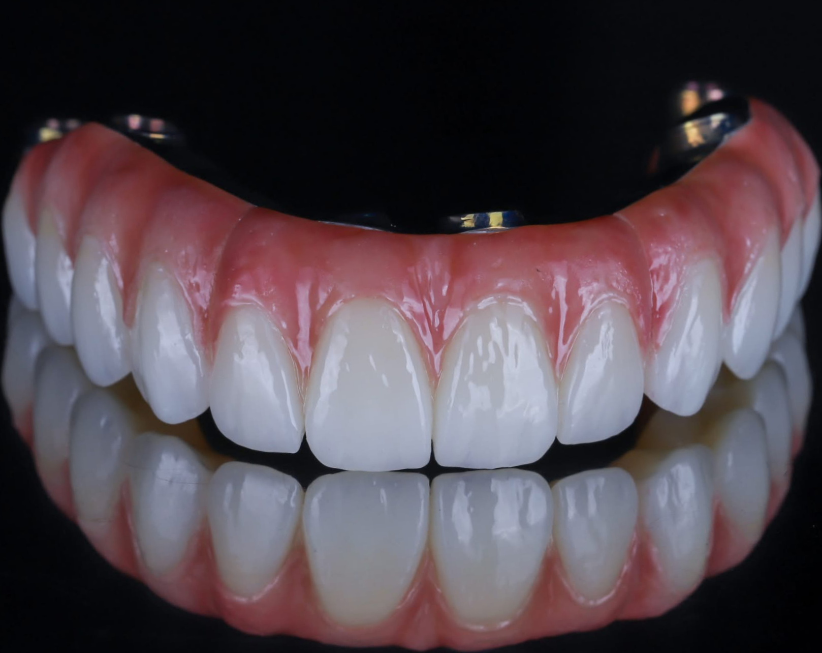 All-On-4 Restoration