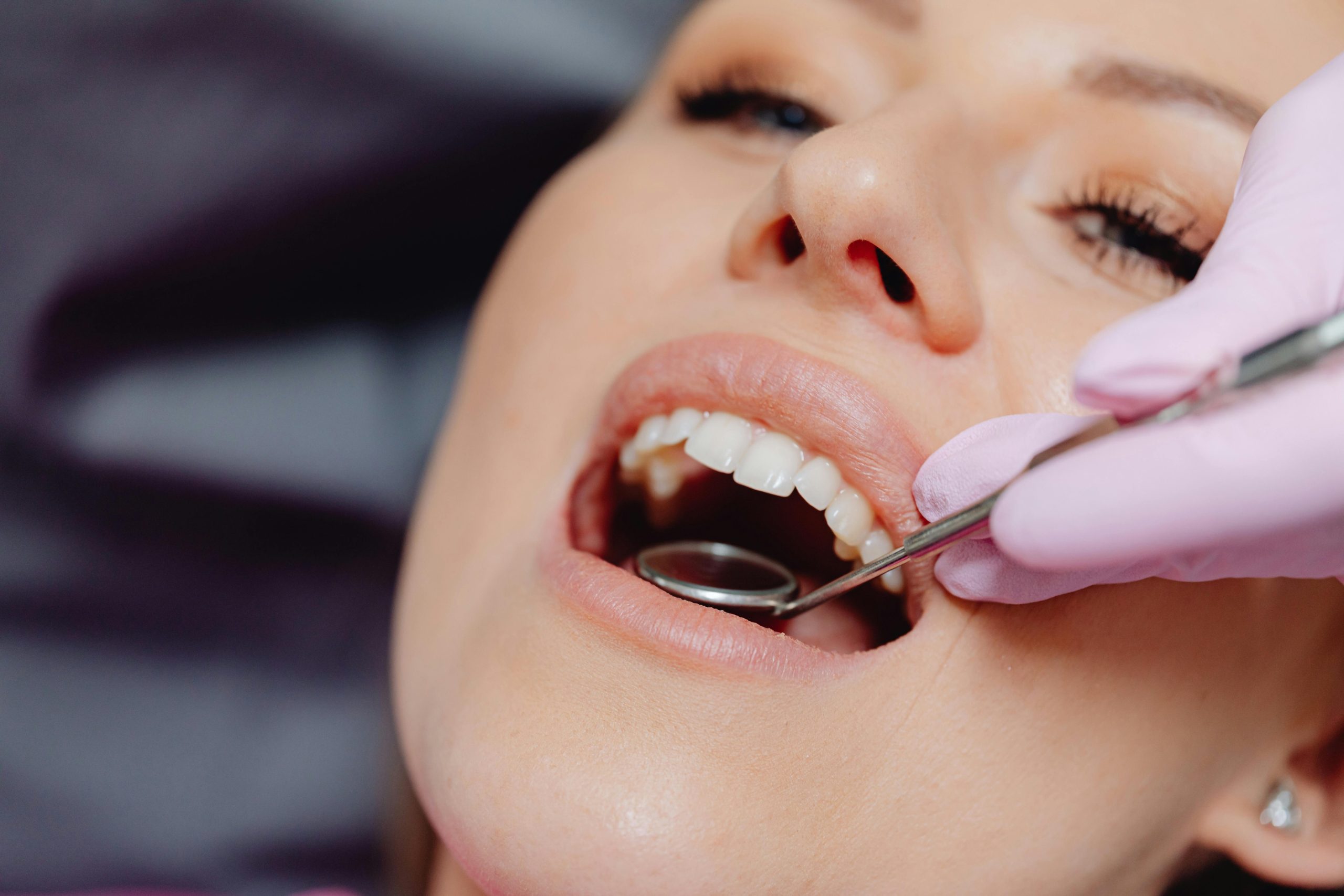 ums bleeding when brushing North Hollywood — early sign of gum disease at A-Dental Center